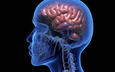 Πλήρης εξαίρεση όγκου εγκεφάλου με τη χρήση αμινολεβουλινικού οξέος